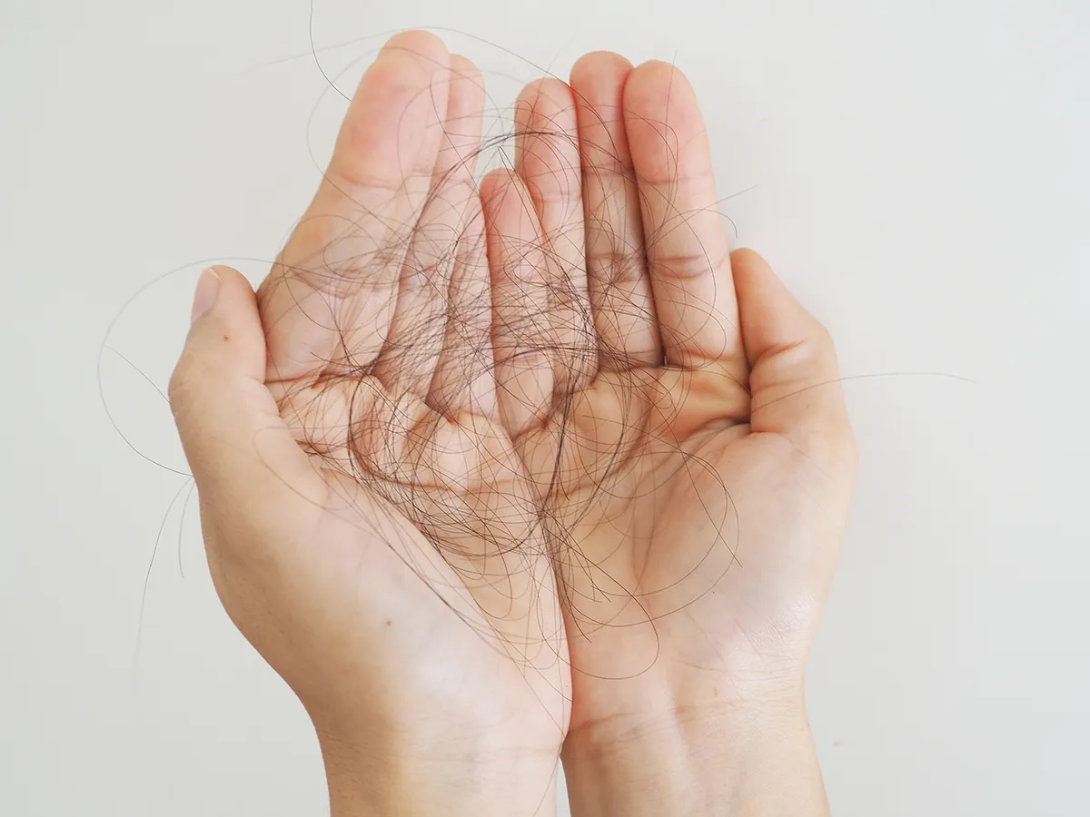 Hair Thinning and Hair Loss